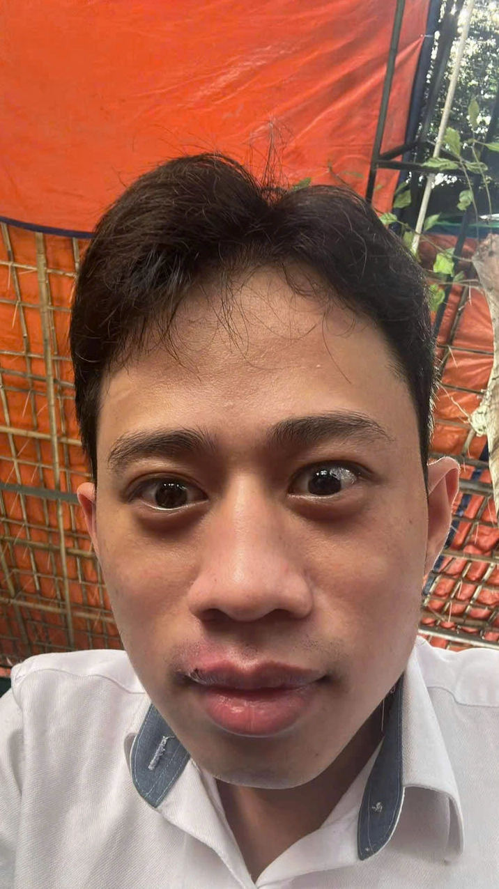 Ảnh meme Simp chúa anh Long trợn mắt tỏ vẻ ngầu